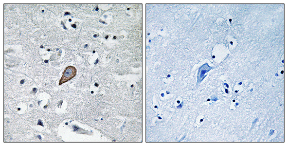 PKC θ Rabbit Polyclonal Antibody | 兔多抗 | EnkiLife恩玑生命
