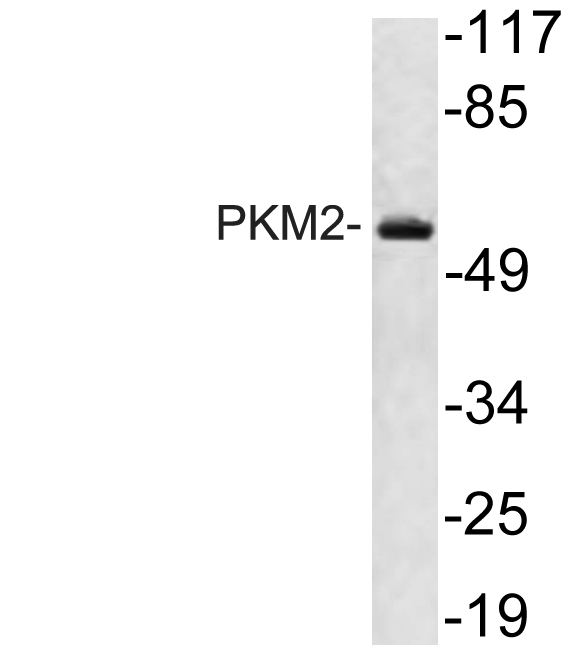 PKM2 Rabbit Polyclonal Antibody | 兔多抗 | EnkiLife恩玑生命