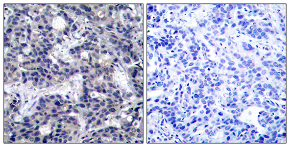 PKR Rabbit Polyclonal Antibody | 兔多抗 | EnkiLife恩玑生命