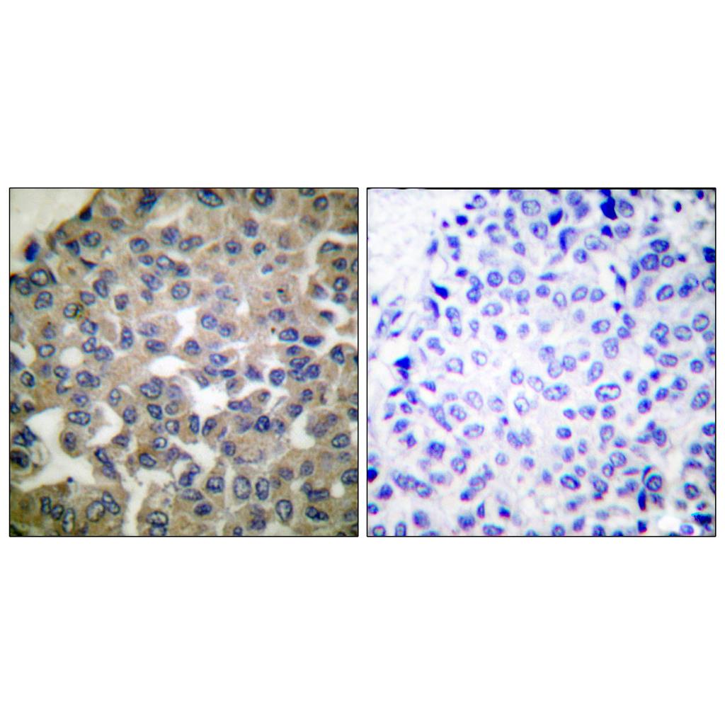PLC γ1 Rabbit Polyclonal Antibody | 兔多抗 | EnkiLife恩玑生命