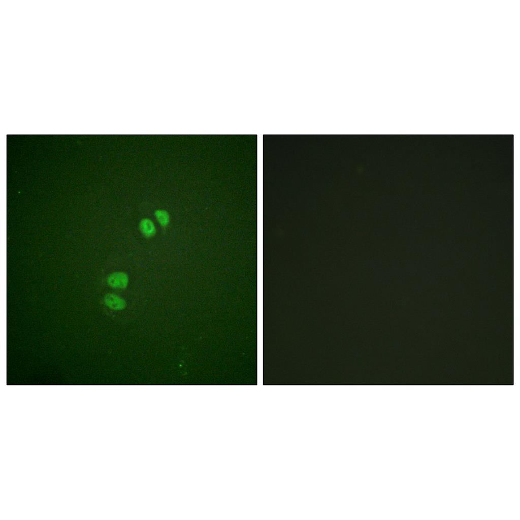 Plk Rabbit Polyclonal Antibody | 兔多抗 | EnkiLife恩玑生命