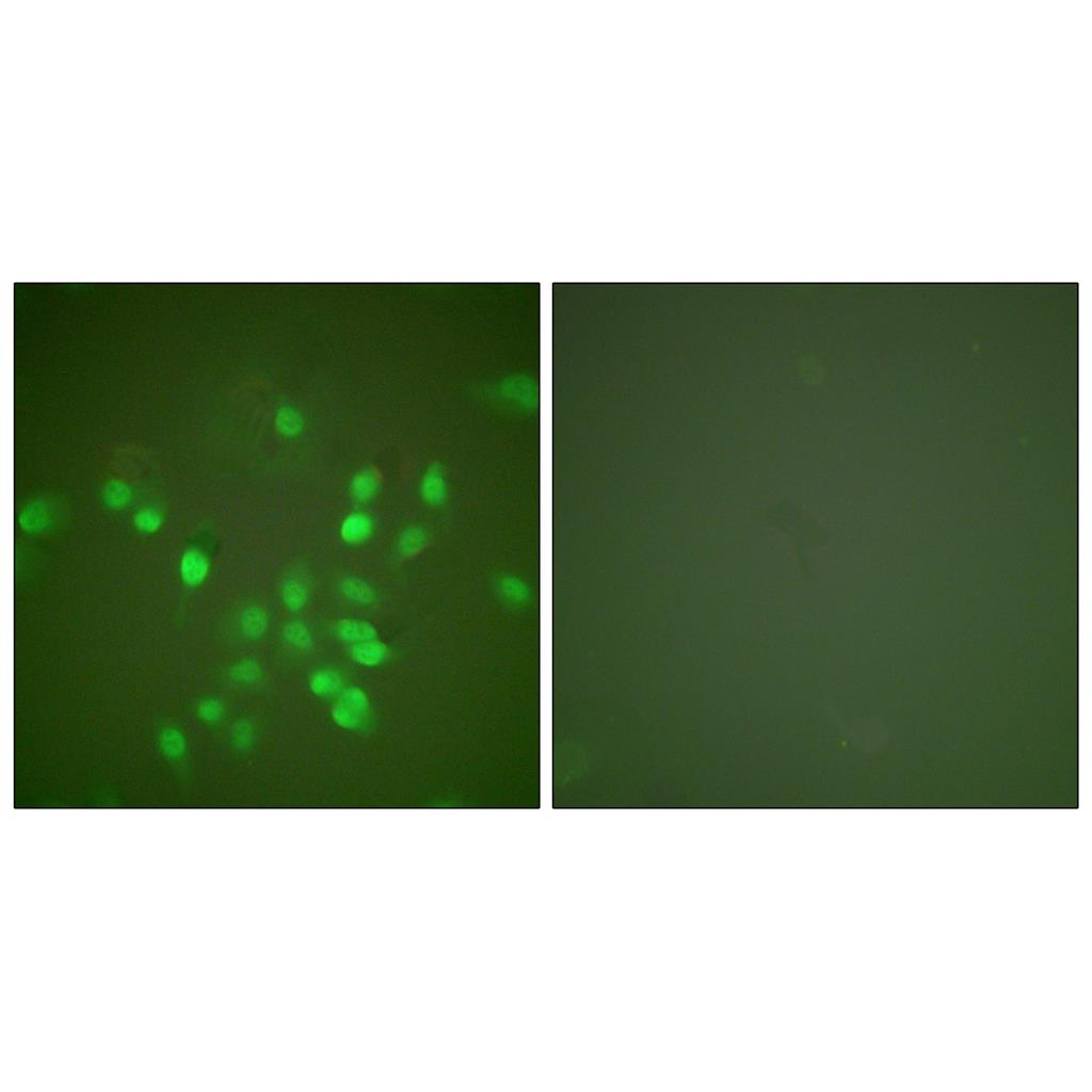 PML Rabbit Polyclonal Antibody | 兔多抗 | EnkiLife恩玑生命