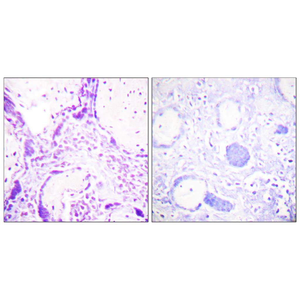 PPAR-γ Rabbit Polyclonal Antibody | 兔多抗 | EnkiLife恩玑生命