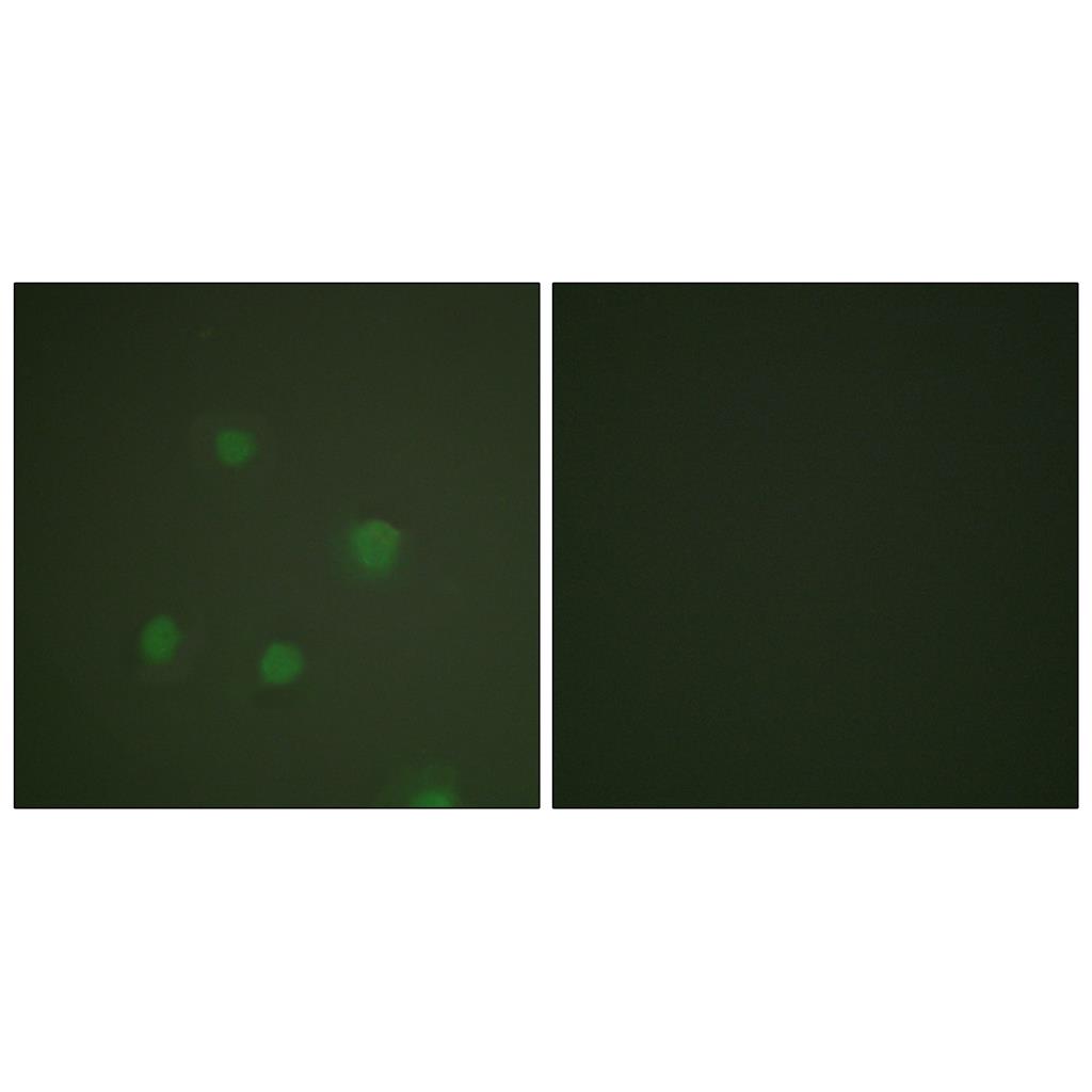 PR Rabbit Polyclonal Antibody | 兔多抗 | EnkiLife恩玑生命