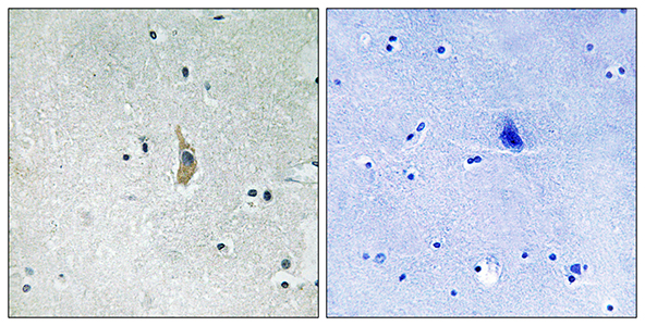 Presenilin 1 Rabbit Polyclonal Antibody | 兔多抗 | EnkiLife恩玑生命