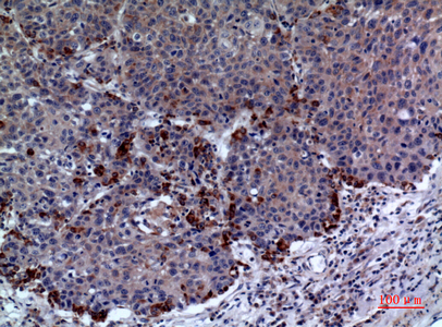 PRX I Rabbit Polyclonal Antibody | 兔多抗 | EnkiLife恩玑生命