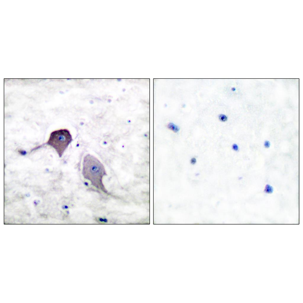 PS-1 Rabbit Polyclonal Antibody | 兔多抗 | EnkiLife恩玑生命