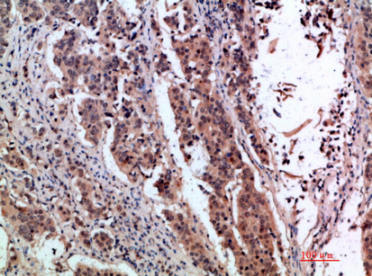pS2 Rabbit Polyclonal Antibody | 兔多抗 | EnkiLife恩玑生命