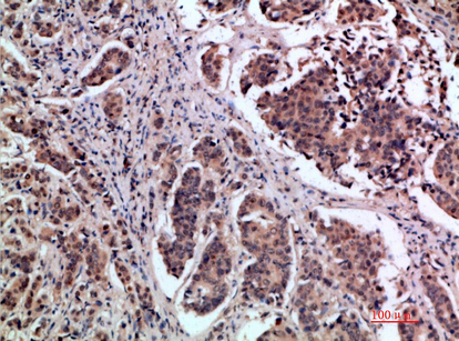 pS2 Rabbit Polyclonal Antibody | 兔多抗 | EnkiLife恩玑生命