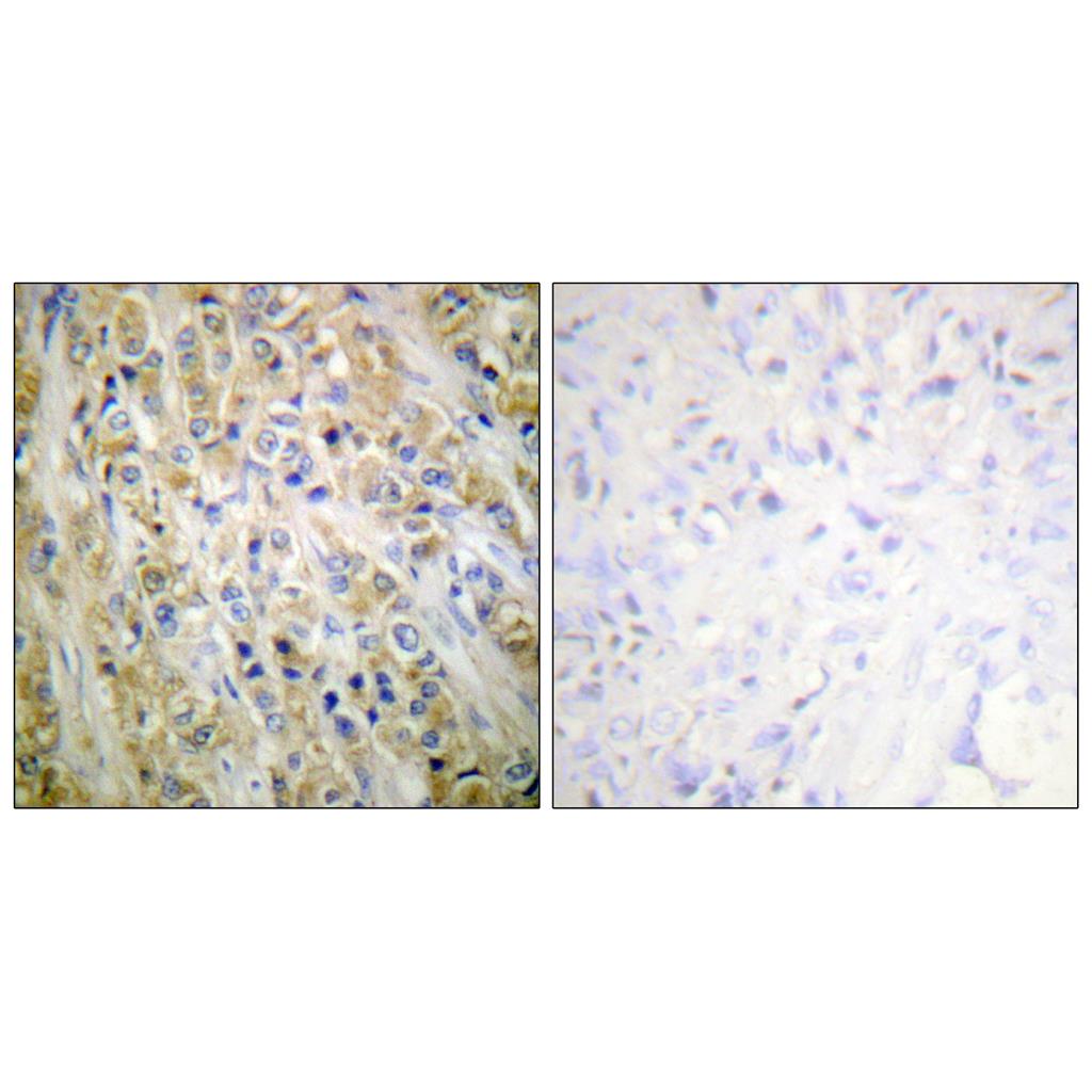 PSA Rabbit Polyclonal Antibody | 兔多抗 | EnkiLife恩玑生命