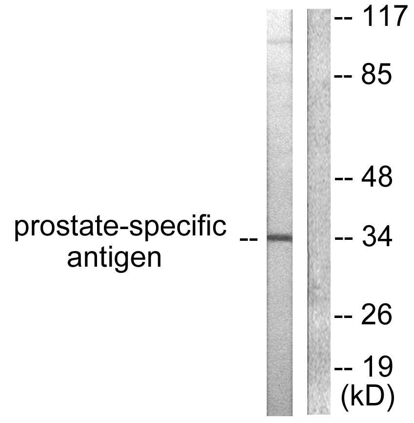 PSA Rabbit Polyclonal Antibody | 兔多抗 | EnkiLife恩玑生命