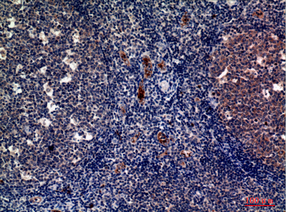 P-Selectin Rabbit Polyclonal Antibody | 兔多抗 | EnkiLife恩玑生命
