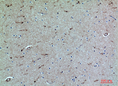 PSGL-1 Rabbit Polyclonal Antibody | 兔多抗 | EnkiLife恩玑生命