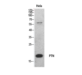 PTN Rabbit Polyclonal Antibody | 兔多抗 | EnkiLife恩玑生命