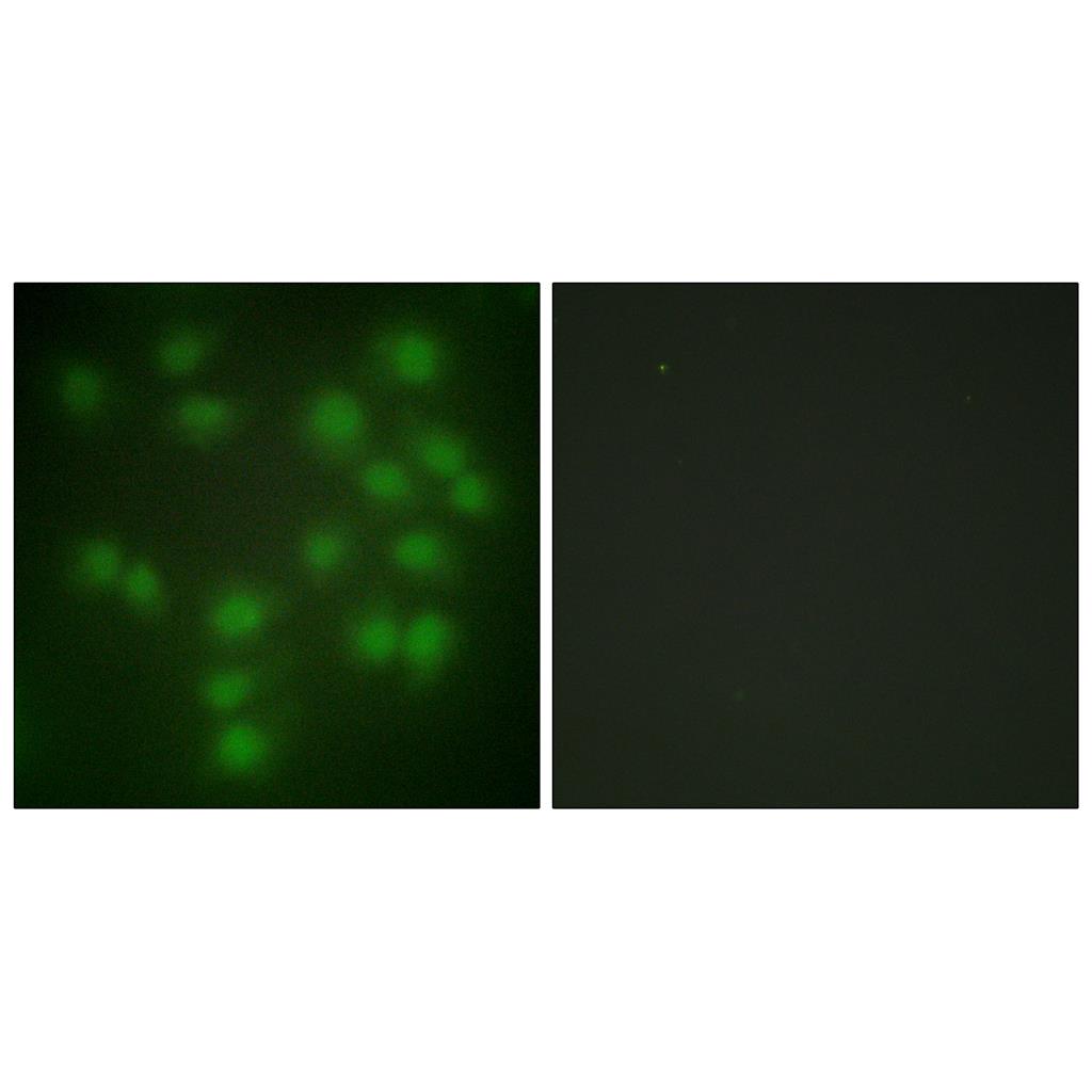 PTTG1/2/3 Rabbit Polyclonal Antibody | 兔多抗 | EnkiLife恩玑生命