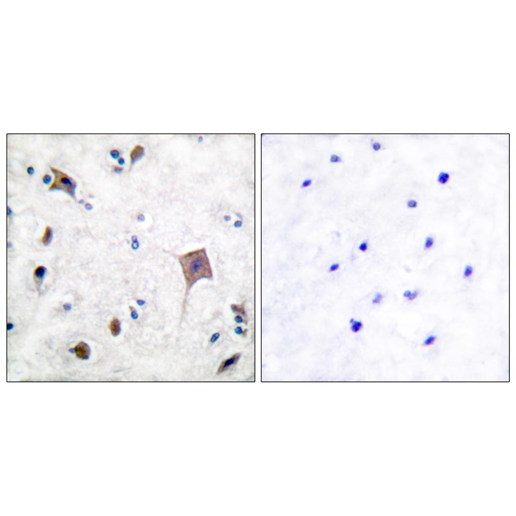 PYK2 Rabbit Polyclonal Antibody | 兔多抗 | EnkiLife恩玑生命