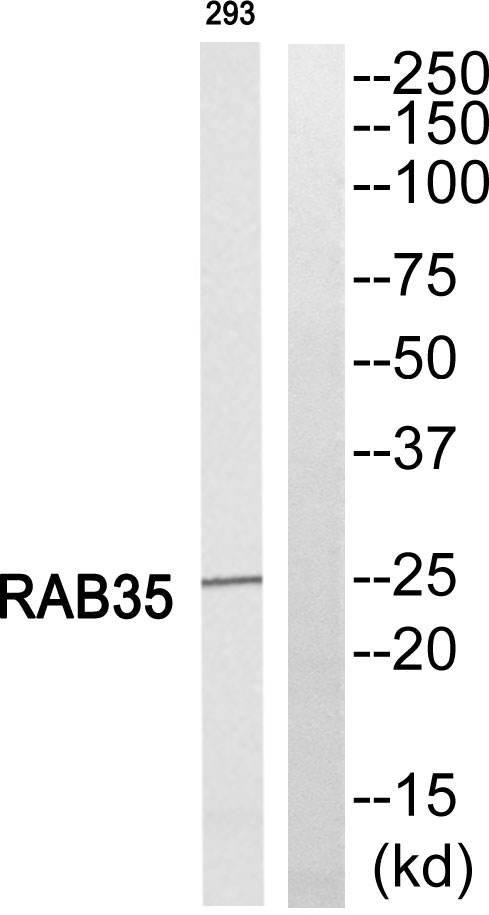 Rab 35 Rabbit Polyclonal Antibody | 兔多抗 | EnkiLife恩玑生命
