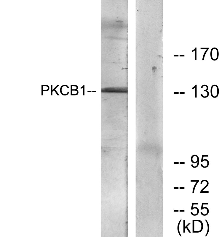 RACK7 Rabbit Polyclonal Antibody | 兔多抗 | EnkiLife恩玑生命