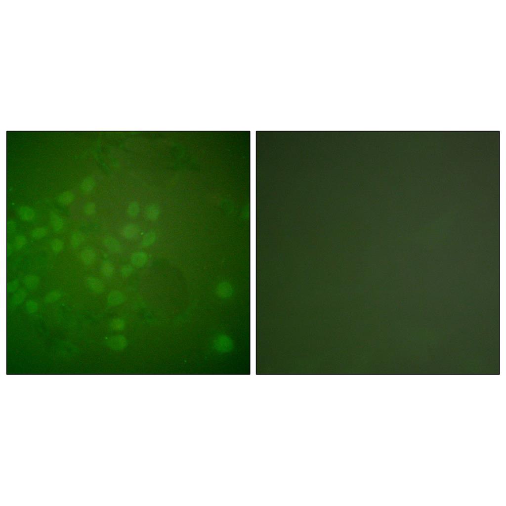 Rad17 Rabbit Polyclonal Antibody | 兔多抗 | EnkiLife恩玑生命