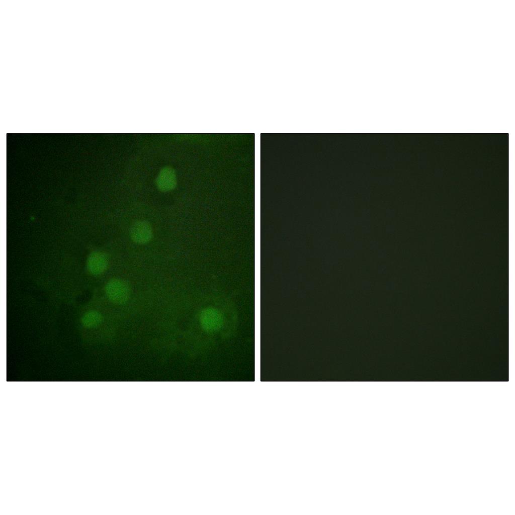 Rad52 Rabbit Polyclonal Antibody | 兔多抗 | EnkiLife恩玑生命