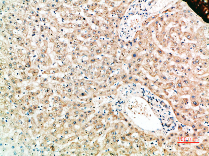 RANK Rabbit Polyclonal Antibody | 兔多抗 | EnkiLife恩玑生命