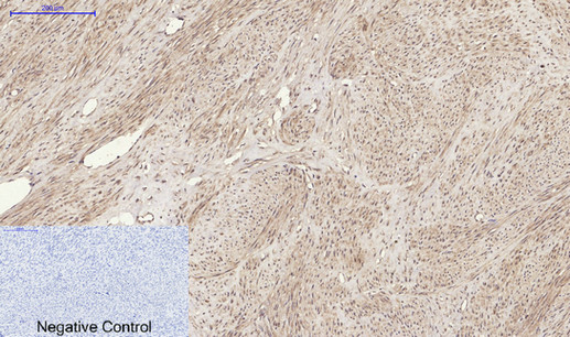 RANKL Rabbit Polyclonal Antibody | 兔多抗 | EnkiLife恩玑生命