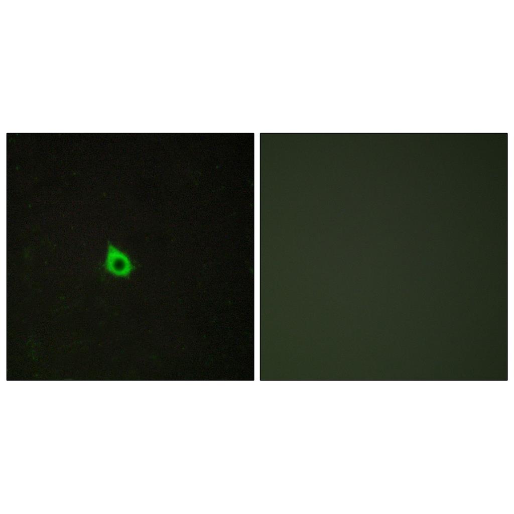 RECK Rabbit Polyclonal Antibody | 兔多抗 | EnkiLife恩玑生命