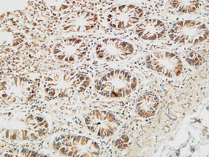 Reg IV Rabbit Polyclonal Antibody | 兔多抗 | EnkiLife恩玑生命