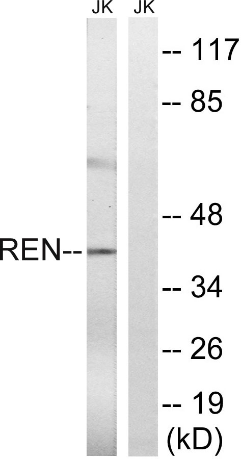 Renin Rabbit Polyclonal Antibody | 兔多抗 | EnkiLife恩玑生命