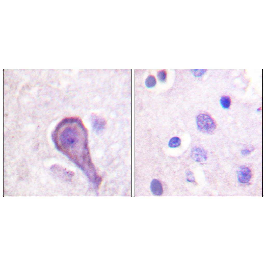 Rhodopsin Rabbit Polyclonal Antibody | 兔多抗 | EnkiLife恩玑生命