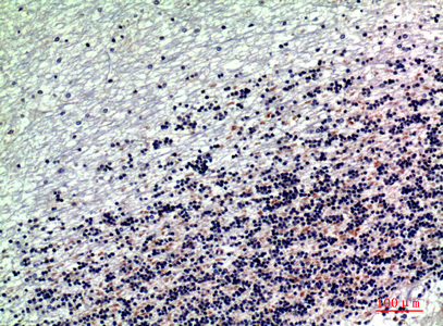 RNase III Drosha Rabbit Polyclonal Antibody | 兔多抗 | EnkiLife恩玑生命