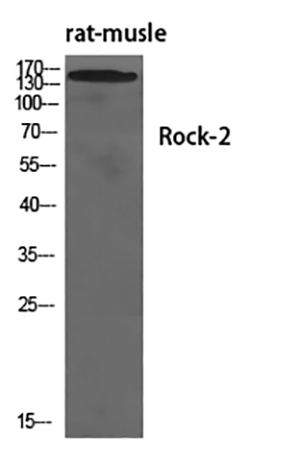 Rock-2 Rabbit Polyclonal Antibody | 兔多抗 | EnkiLife恩玑生命