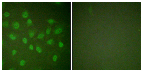 Rpb1 Rabbit Polyclonal Antibody | 兔多抗 | EnkiLife恩玑生命