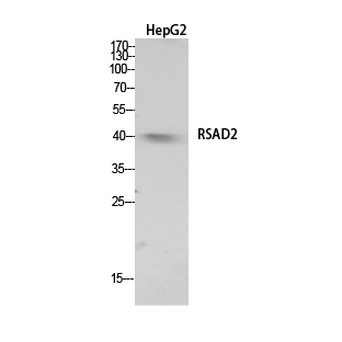 RSAD2 Rabbit Polyclonal Antibody | 兔多抗 | EnkiLife恩玑生命
