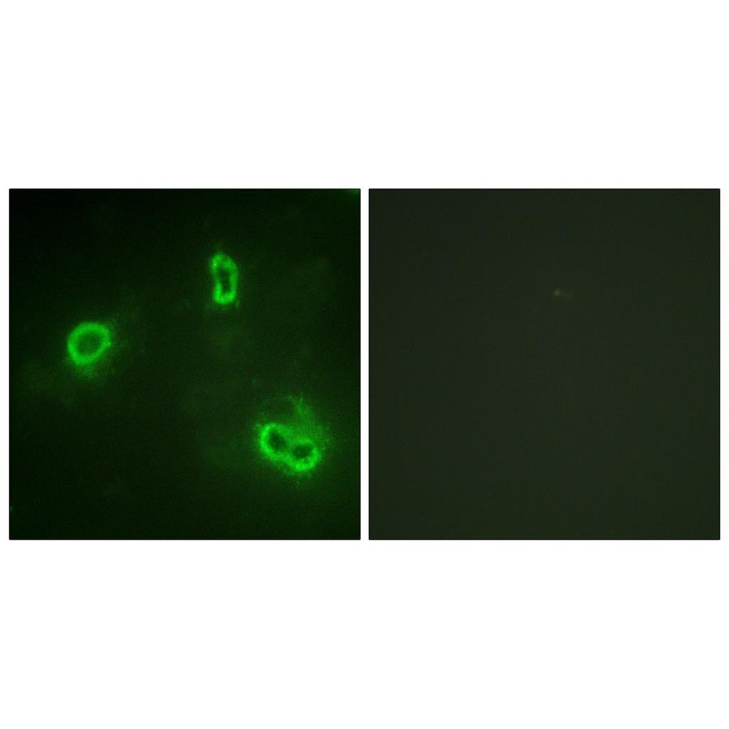 Rsk-1 Rabbit Polyclonal Antibody | 兔多抗 | EnkiLife恩玑生命