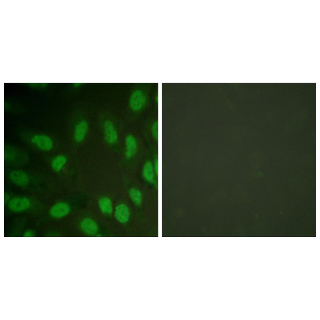 RUNX1 Rabbit Polyclonal Antibody | 兔多抗 | EnkiLife恩玑生命