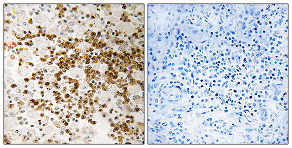 S-100P Rabbit Polyclonal Antibody | 兔多抗 | EnkiLife恩玑生命