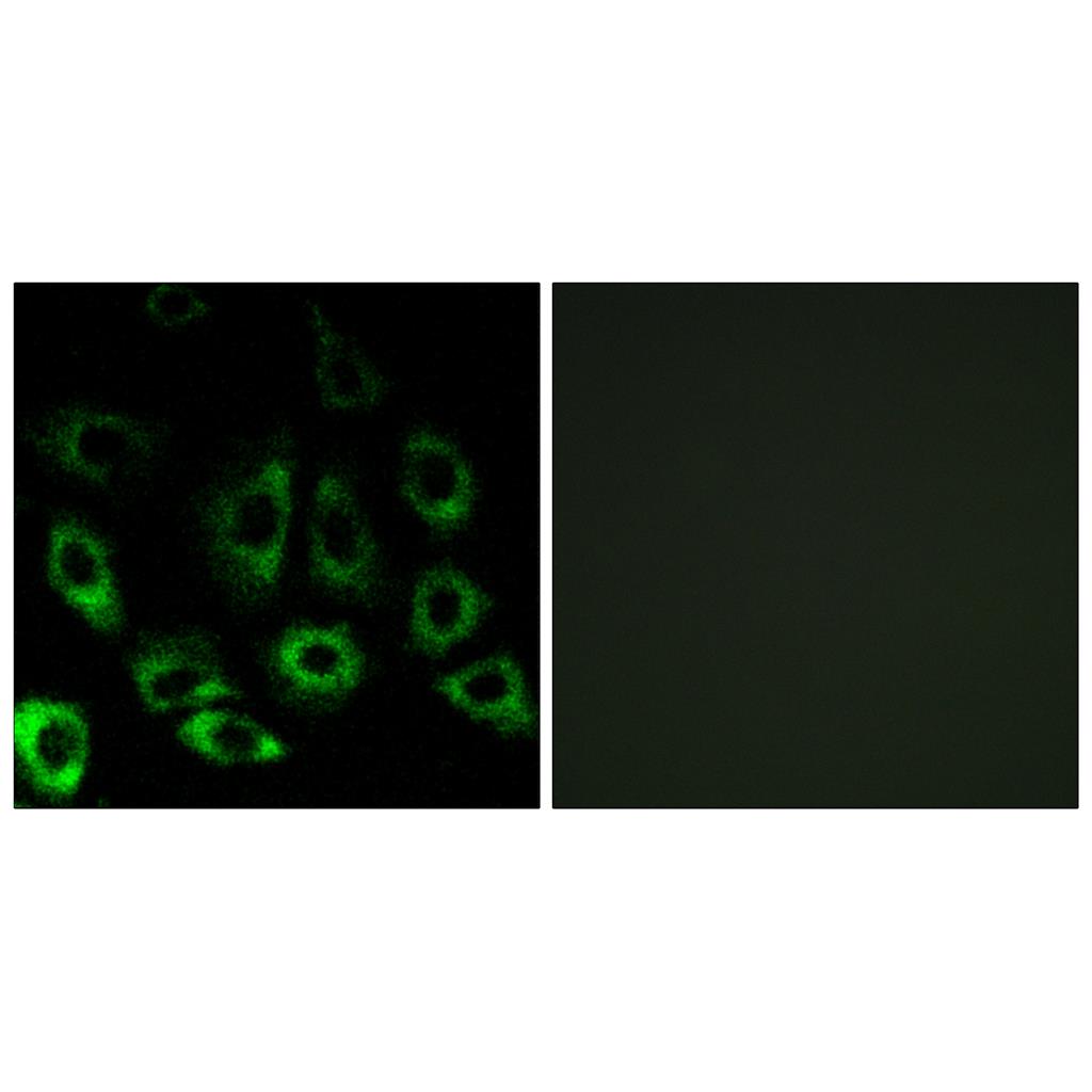 S2P Rabbit Polyclonal Antibody | 兔多抗 | EnkiLife恩玑生命