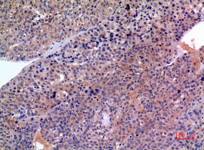 SCCA1/2 Rabbit Polyclonal Antibody | 兔多抗 | EnkiLife恩玑生命