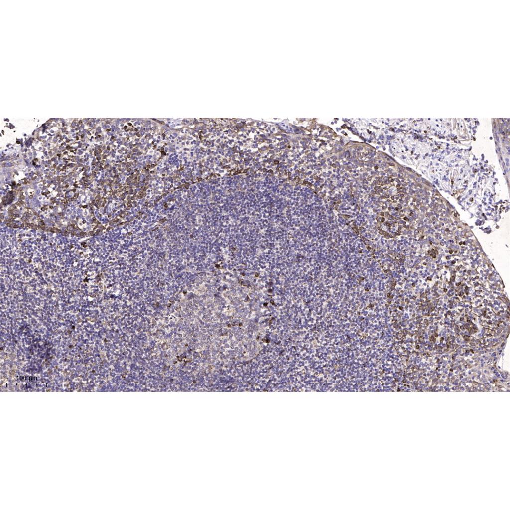 SCN1A Rabbit Polyclonal Antibody | 兔多抗 | EnkiLife恩玑生命