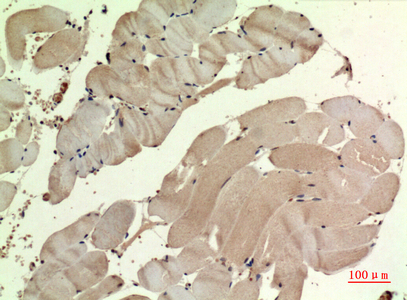 SDHB Rabbit Polyclonal Antibody | 兔多抗 | EnkiLife恩玑生命