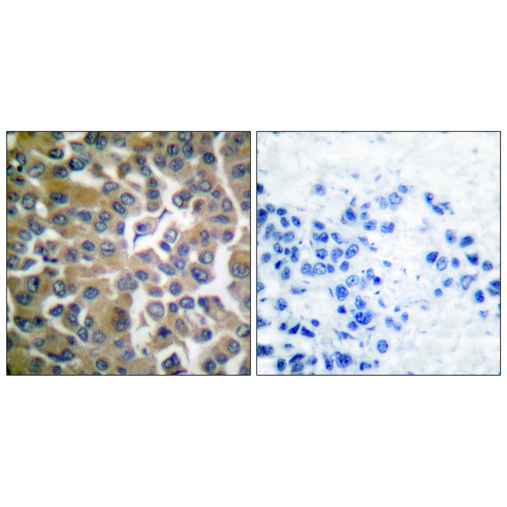 Seprase Rabbit Polyclonal Antibody | 兔多抗 | EnkiLife恩玑生命