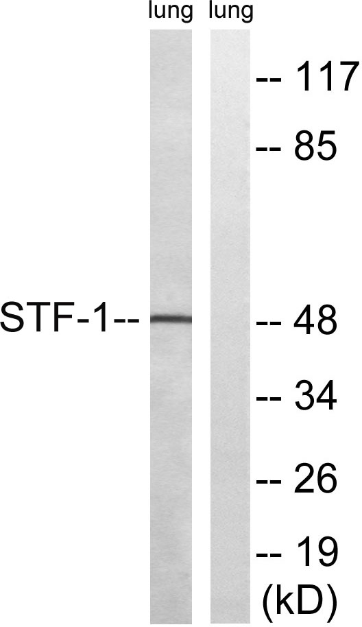 SF-1 Rabbit Polyclonal Antibody | 兔多抗 | EnkiLife恩玑生命