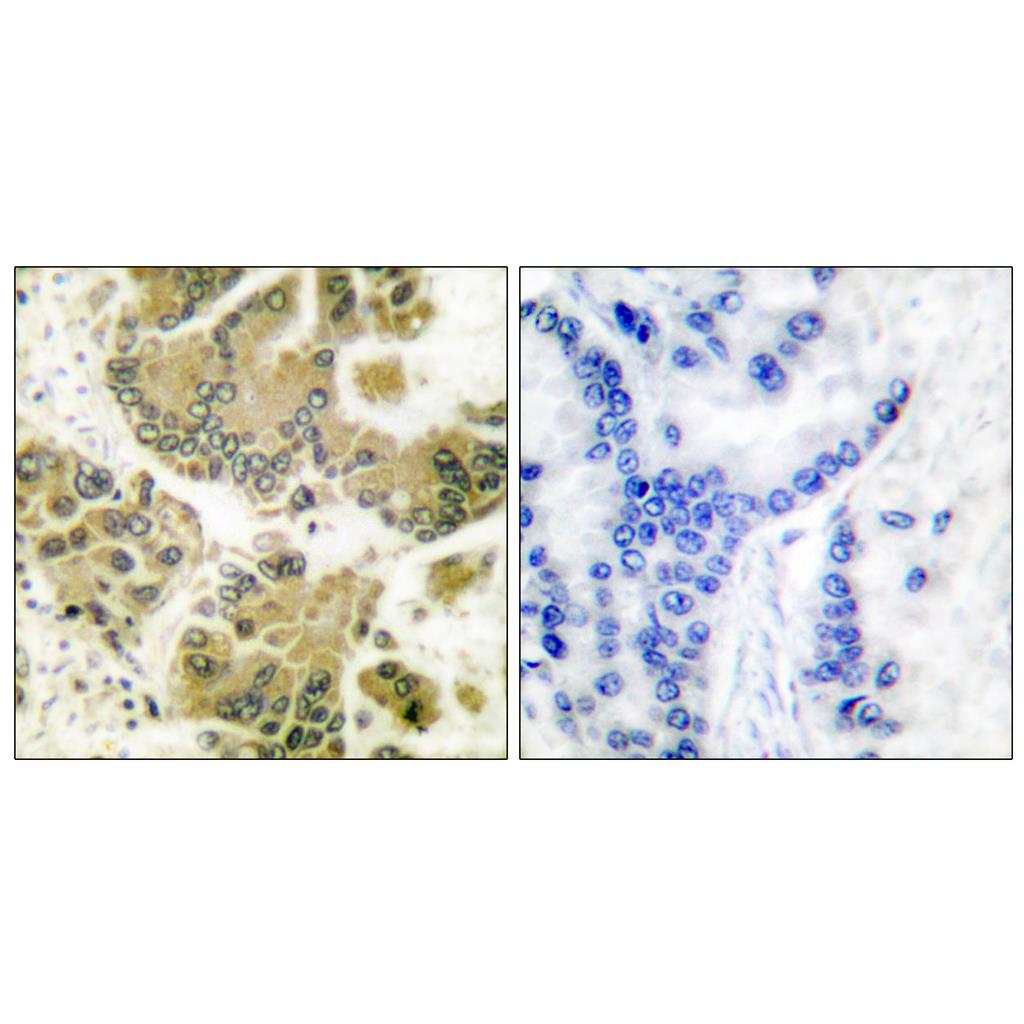 SGK1 Rabbit Polyclonal Antibody | 兔多抗 | EnkiLife恩玑生命