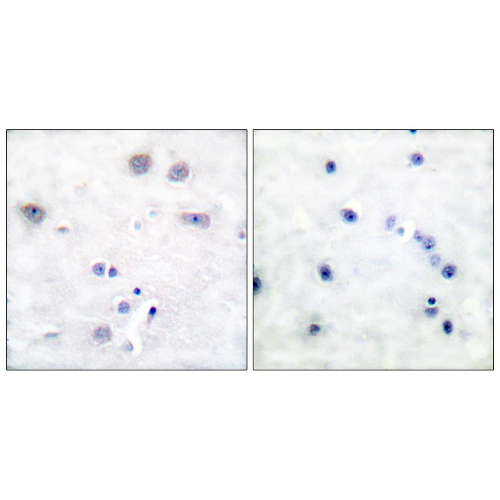 Shc Rabbit Polyclonal Antibody | 兔多抗 | EnkiLife恩玑生命