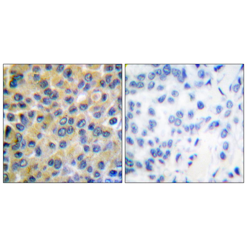 SH-PTP2 Rabbit Polyclonal Antibody | 兔多抗 | EnkiLife恩玑生命