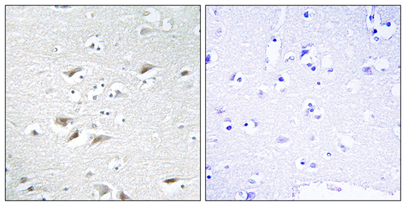 SIP1 Rabbit Polyclonal Antibody | 兔多抗 | EnkiLife恩玑生命