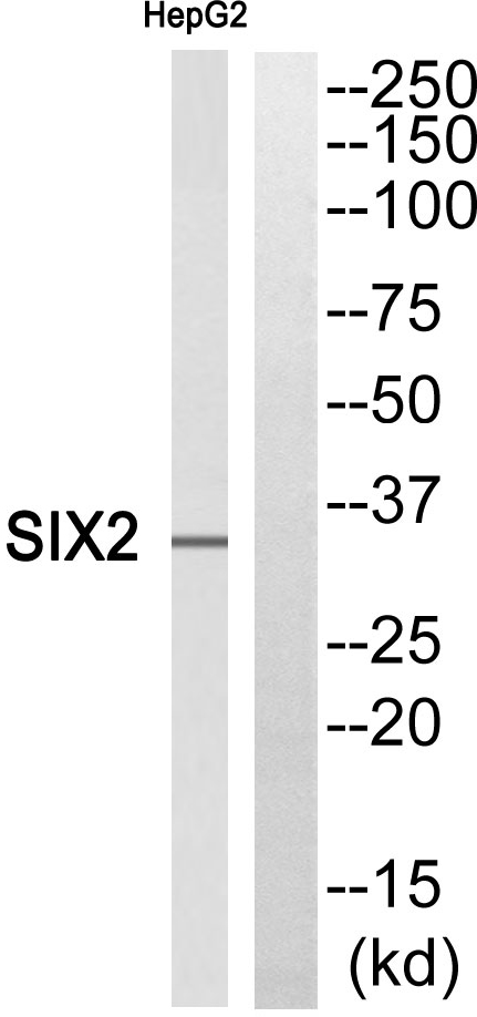 Six2 Rabbit Polyclonal Antibody | 兔多抗 | EnkiLife恩玑生命