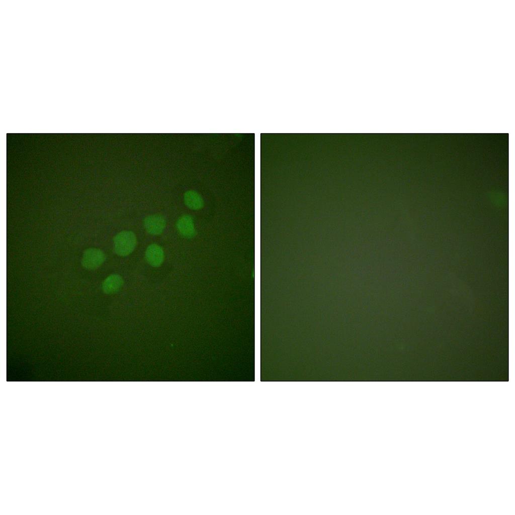 Skp2 p45 Rabbit Polyclonal Antibody | 兔多抗 | EnkiLife恩玑生命