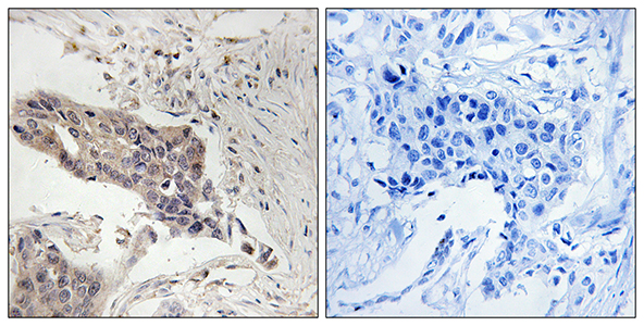 SLP-76 Rabbit Polyclonal Antibody | 兔多抗 | EnkiLife恩玑生命